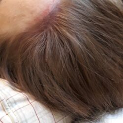 hiusrajan muotoilua lopputilanne