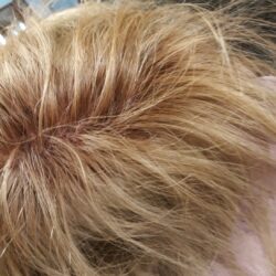 jakauksen peittäminen pigmentoinnilla