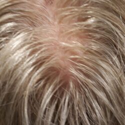 kulunut jakaus hiuspigmentointi