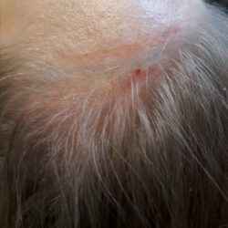 lähtötilanne hiusrajan vasemmalla puolella